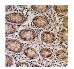 2 - Anti-NTPCR Antibody ABV11963