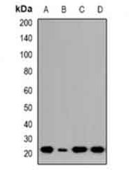 1 - Anti-NTPCR Antibody ABV11963