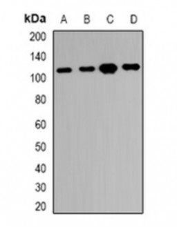 1 - Anti-RBM26 Antibody  ABV11965