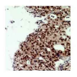 2 - Anti-CNOT7 Antibody  ABV11966