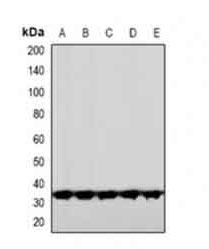 1 - Anti-CNOT7 Antibody  ABV11966