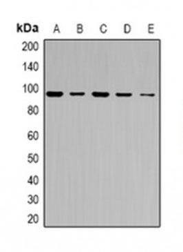 1 - Anti-ABCF1 Antibody ABV11967