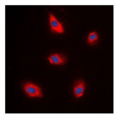 3 - Anti-EPS8L1 Antibody ABV11969