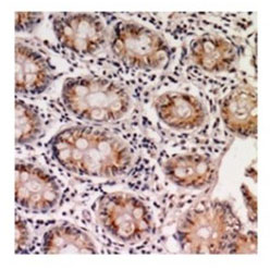 2 - Anti-EPS8L1 Antibody ABV11969