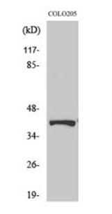 1 - Phospho-AMPKβ1 (Ser182) Antibody ABV11979