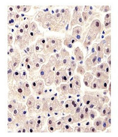 2 - Anti-GPT/ALT1 Antibody ABV12002