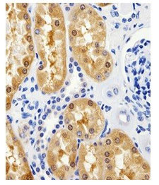 2 - Anti-GPT/ALT1 Antibody ABV12002