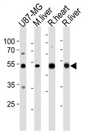 1 - Anti-GPT/ALT1 Antibody ABV12002