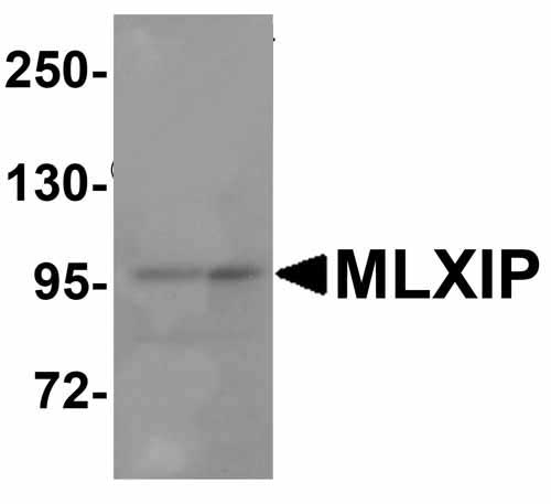 1 - MLXIP Antibody ASC12034