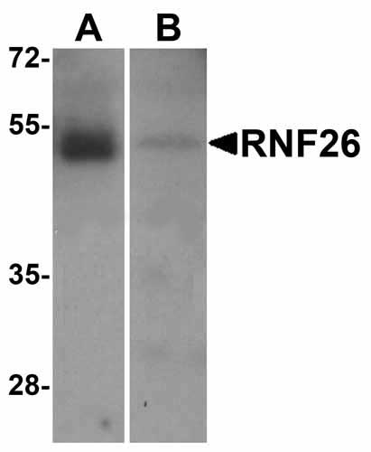 1 - RNF26 Antibody ASC12035