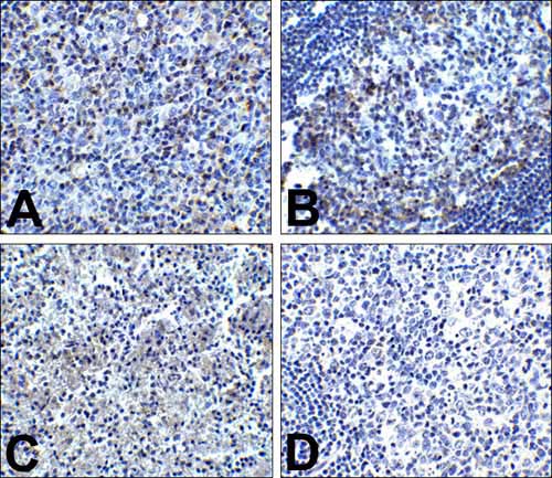 2 - PD-1 Antibody [7H6] ASC12038