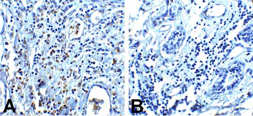 2 - PD-1 Antibody [7H6] ASC12038