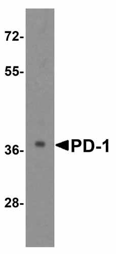 1 - PD-1 Antibody [7H6] ASC12038