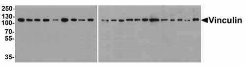 1 - Vinculin Antibody [8B5] ASC12051
