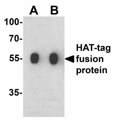 1 - HAT-tag Antibody ASC12057