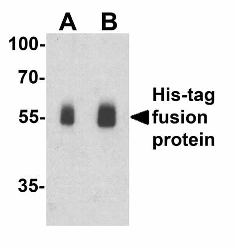 1 - His-tag Antibody ASC12058