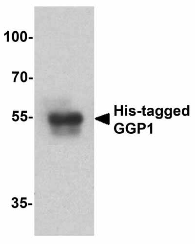 1 - His-tag Antibody ASC12058