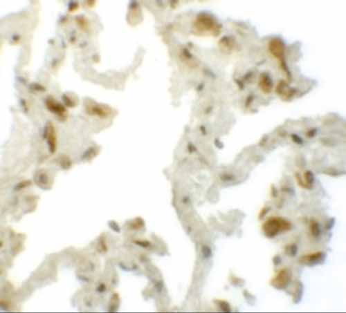 2 - TM4SF1 Antibody ASC12068