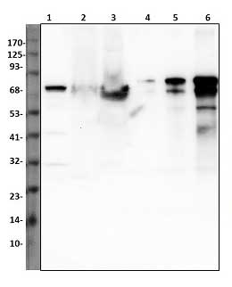 1 - Anti-HMG CoA Reductase Antibody ABV12035