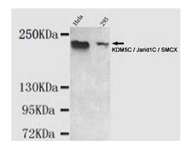 1 - Anti-KDM5C / Jarid1C / SMCX Antibody ABV12039
