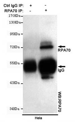 5 - Anti-RPA70 Antibody (8C3-D12-H10) ABV12048