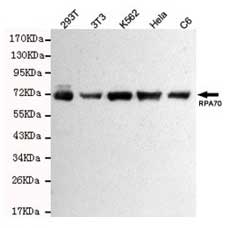 1 - Anti-RPA70 Antibody (8C3-D12-H10) ABV12048