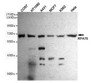 1 - Anti-RPA70 Antibody (8C3-D12-H10) ABV12048