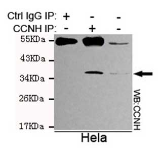 5 - Anti-Cyclin H Antibody (1H9-D3-E11) ABV12051