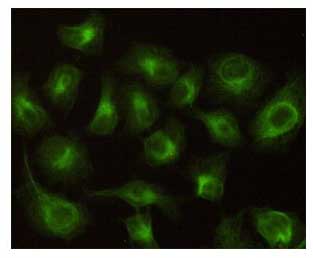 8 - Anti-CBR1 Antibody (2C9-B12-C4) ABV12056