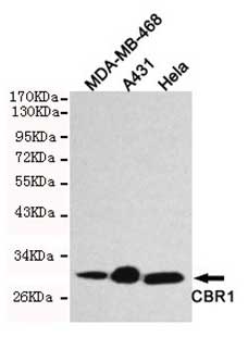 1 - Anti-CBR1 Antibody (2C9-B12-C4) ABV12056