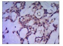 2 - Anti-PPP1A Antibody (1C11-C10-H5-E9) ABV12059