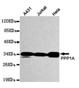 1 - Anti-PPP1A Antibody (1C11-C10-H5-E9) ABV12059