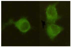 8 - Anti-Mannose Phosphate Isomerase Antibody (4G9-B4-B8)                                       
 ABV12060