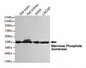 1 - Anti-Mannose Phosphate Isomerase Antibody (4G9-B4-B8)                                       
 ABV12060