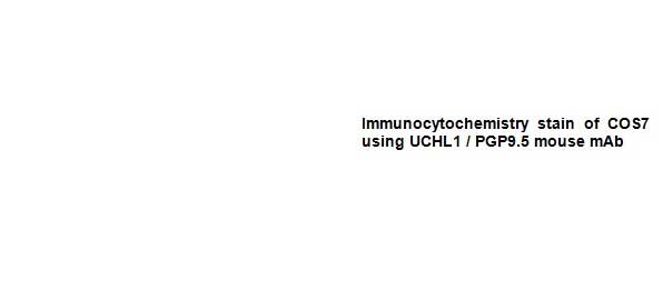 8 - Anti-UCHL1 Antibody (7B8-G5-B8) ABV12063