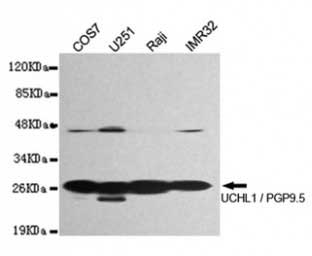 1 - Anti-UCHL1 Antibody (7B8-G5-B8) ABV12063