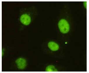 8 - Anti-KIAA1967 Antibody (3G4-D11-D7) ABV12067