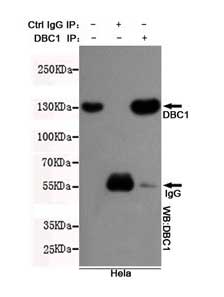 5 - Anti-KIAA1967 Antibody (3G4-D11-D7) ABV12067