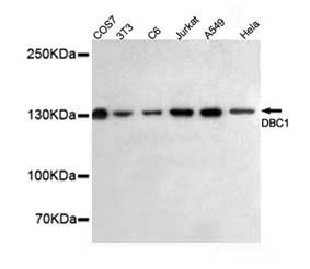1 - Anti-KIAA1967 Antibody (3G4-D11-D7) ABV12067