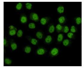 8 - Anti-SMC1A Antibody (4C5-C8-A11) ABV12068