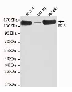 1 - Anti-SMC1A Antibody (4C5-C8-A11) ABV12068