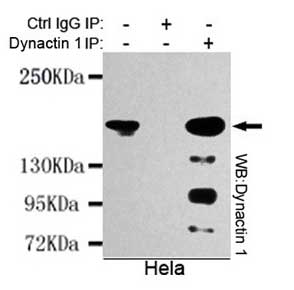 5 - Anti-DCTN1 Antibody (3D5-C6-D5) ABV12072