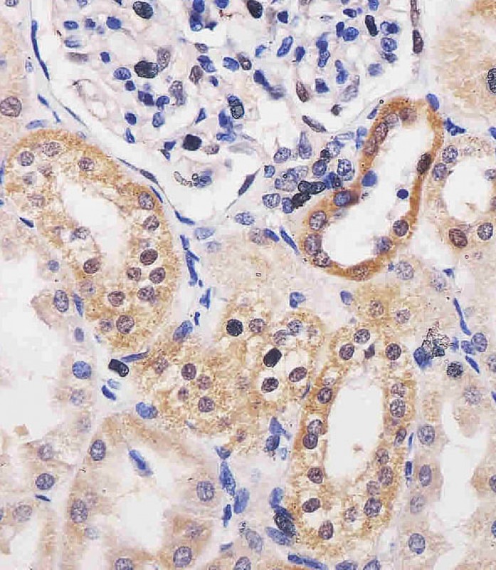 14 - ADK Antibody (N-term) AM8619b