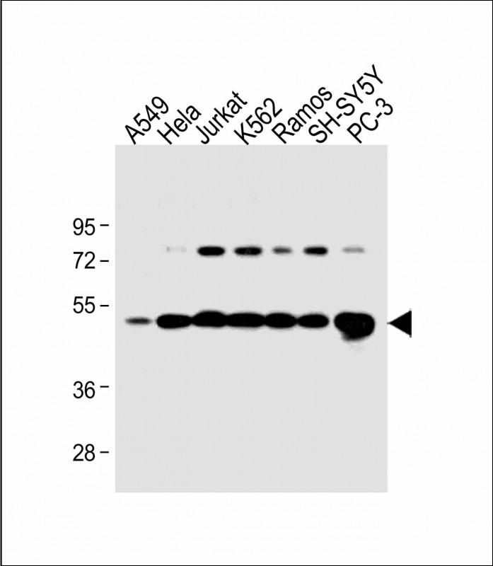 1 - CALR Antibody (Center) AP6898C