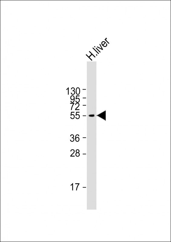 1 - FADS2 Antibody (N-term) AP12296A