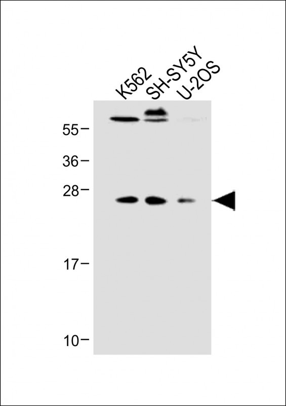 1 - N6AMT1 Antibody (N-term) AP18103a