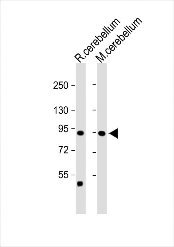 1 - TRPV1 Antibody (N-term) AP13988a