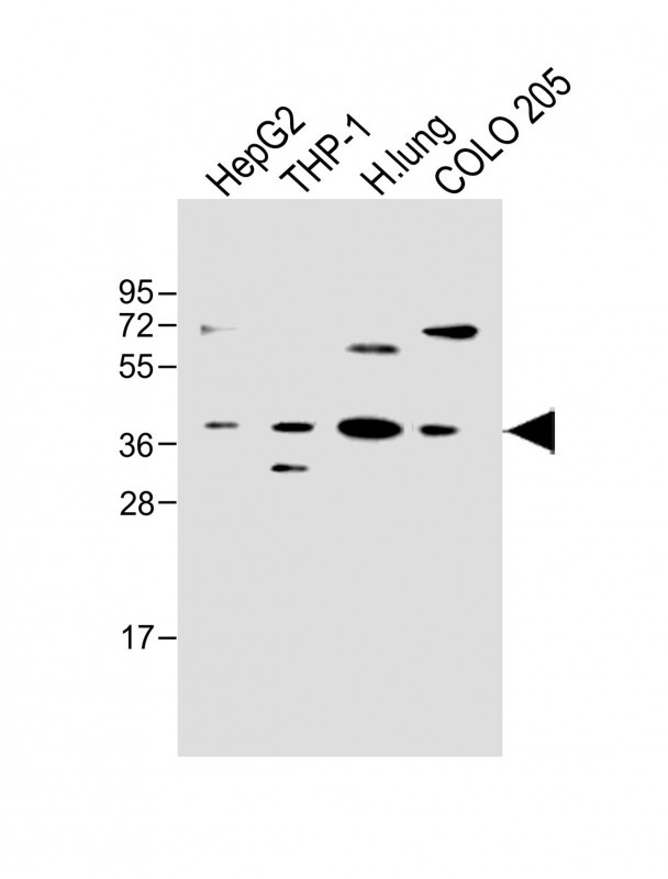 1 - FCGRT Antibody (C-term) AP19288b