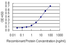 10 - SKIV2L monoclonal antibody (M05), clone 1E5 AT4671a