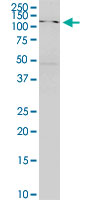 1 - SKIV2L monoclonal antibody (M05), clone 1E5 AT4671a